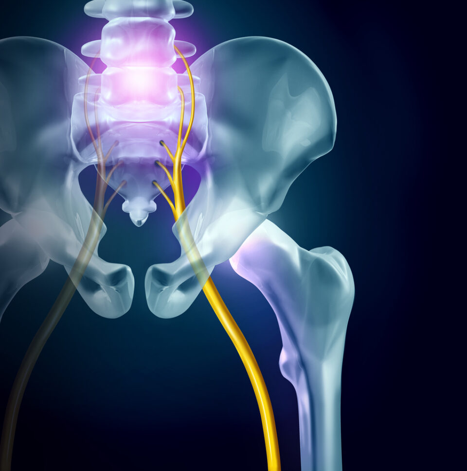 Spinal Stenosis